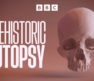 Prehistoric Autopsy