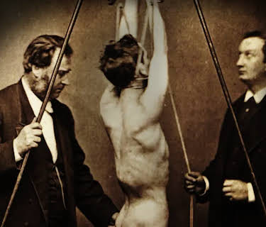 On the Shoulders of Giants: The History of NYU Langone Orthopedics (2024)