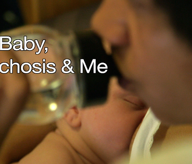 My Baby, Psychosis & Me (2016)