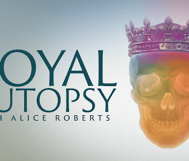 Royal Autopsy