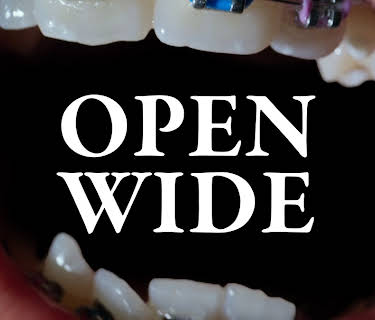 Open Wide (2024)