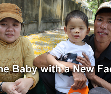 The Baby with a New Face (2017)