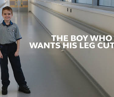 The Boy Who Wants His Leg Cut Off (2015)
