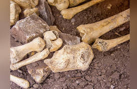 Food, Science, and the Human Body: Stones, Bones, and Teeth