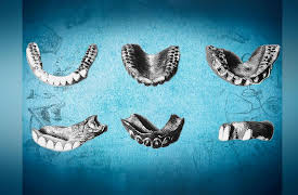 From Handsaw to Scalpel: DENTISTRY AND OPHTHALMOLOGY