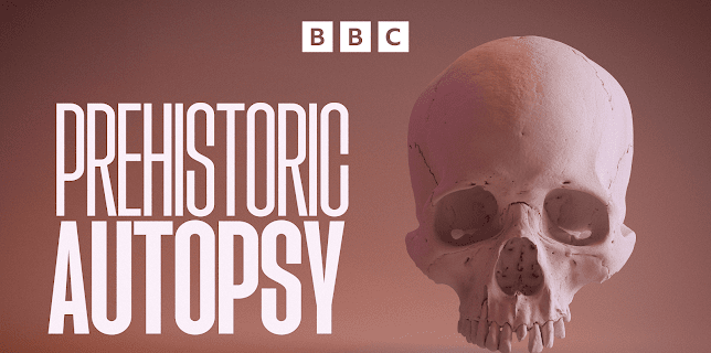 Prehistoric Autopsy