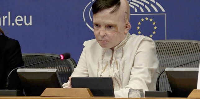 03:40: Mit offenen Augen | Arte | 2/24 2026