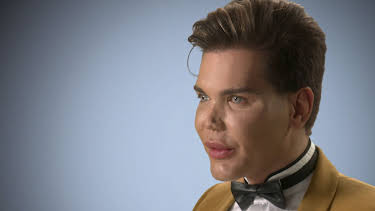 00:25: Verpfuscht - Ein Fall für die Beauty-Docs | Sixx | 4/12 2026