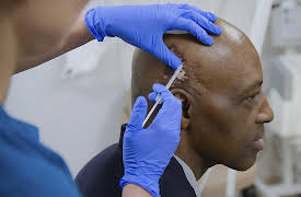 Save My Skin: This Is the Alien Part of Me