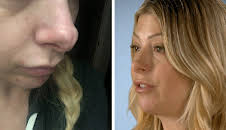 Verpfuscht - Ein Fall für die Beauty-Docs