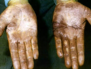 03:35: Medical Detectives - Geheimnisse der Gerichtsmedizin | VOX | 4/7 2026