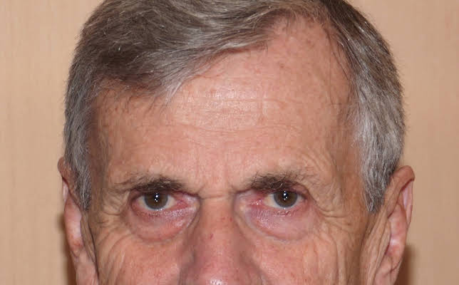 William B. Davis