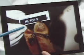 Exhibit A: Secrets of Forensic Science: Bone of Contention