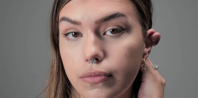 23:25: The Bad Skin Clinic (S3 E4) (S3) | TLC | 8/13 2025