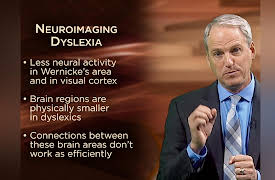 The Learning Brain: Dyslexia and Other Learning Disabilities