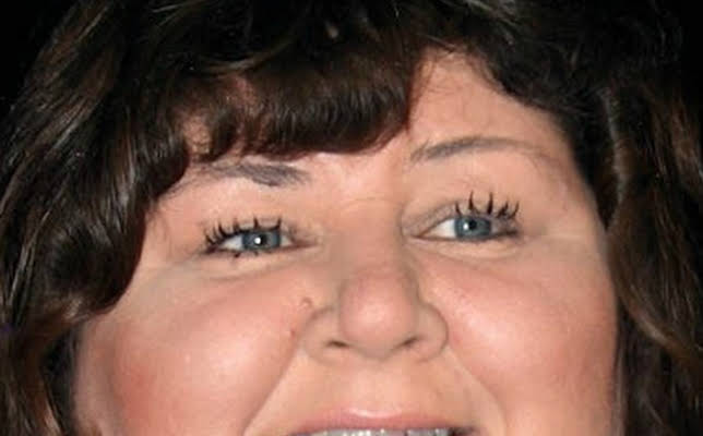 Cheryl Fergison