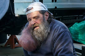 Take My Tumor, Season 1: The Man With the Talking Neck Tumor