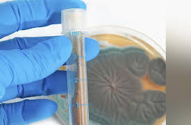 Turning Points in Modern History: 1928-The Discovery of Penicillin