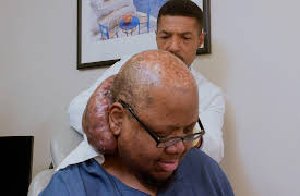 Take My Tumor, Season 1: The Man With the Spicy Tumor