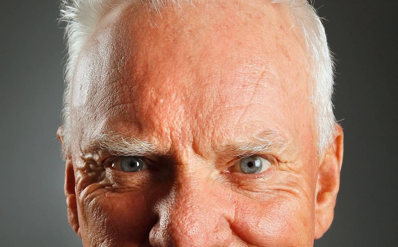 Malcolm McDowell