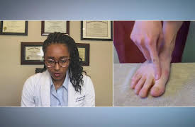 My Feet are Killing Me: Footnotes: Covid Toes