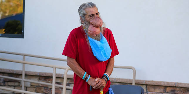 00:25: Dr. Pimple Popper (S3 E19) (S3) | TLC | 11/14 2025