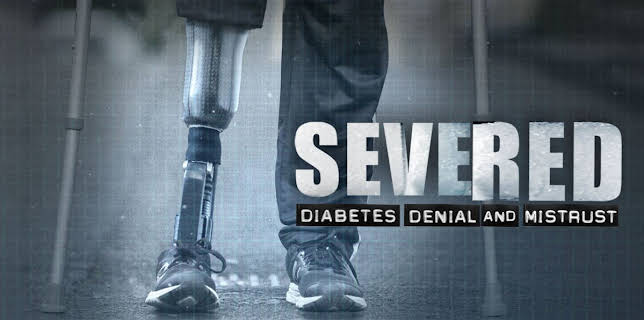 Severed: Diabetes Denial and Mistrust  (2026)