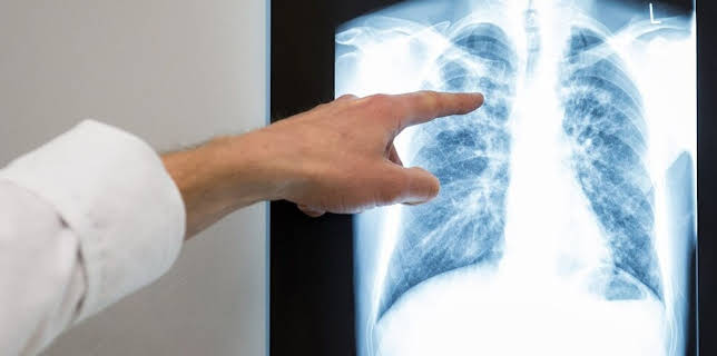 11:40: aktiv und gesund | SWR Fernsehen RP | 3/23 2026