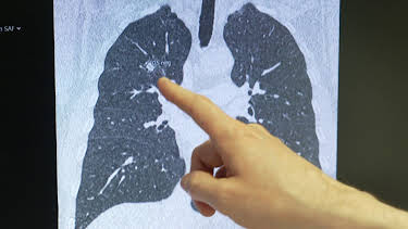 06:00: Gesundheit! | BR Fernsehen | 4/5 2026