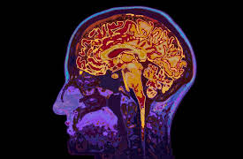 Understanding Disorders of the Brain: Anatomy and Functioning of the Brain