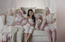 Born With Albinism: Meet the Grabowskis