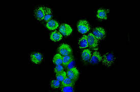 Understanding the Brain: Parkinson's Disease