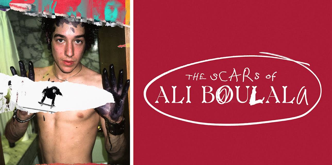 The Scars of Ali Boulala (2025)