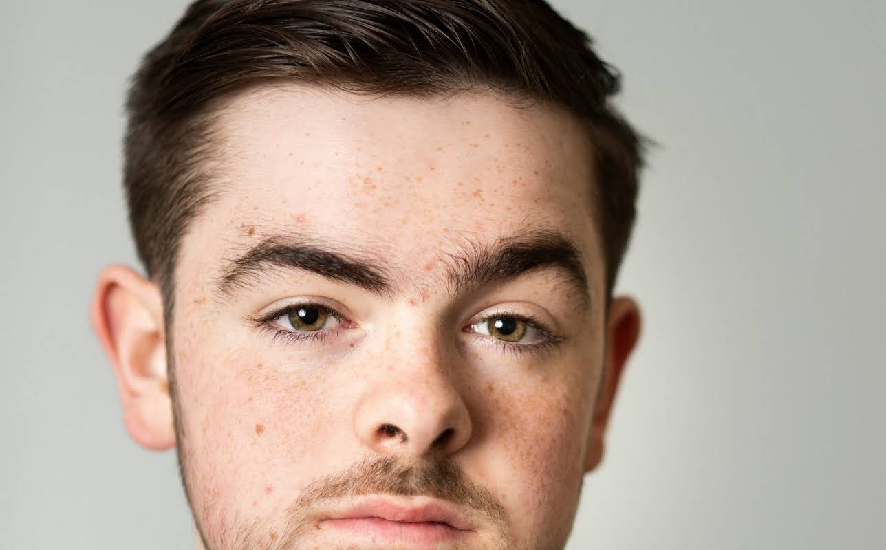 Alfie Simmons