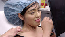 Dr. Pimple Popper (S1 E11)