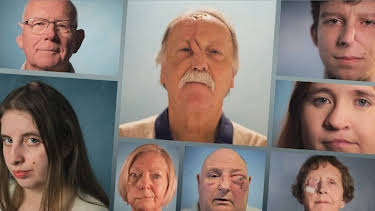 04:02: Cirugía facial | DKISS | 4/9 2026