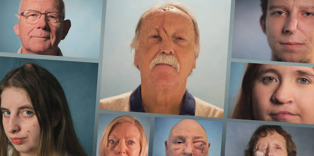 03:02: Cirugía facial | DKISS | 1/9 2026