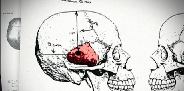 02:10: Medical Detectives - Geheimnisse der Gerichtsmedizin | VOX | 12/8 2025