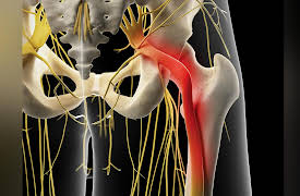 How We Move: The Gross Anatomy of Motion: Nerve Plexuses of the Lower Limb
