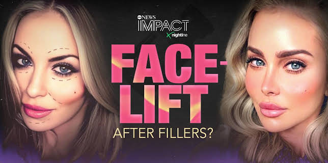 IMPACT x Nightline: Facelift: After Fillers?