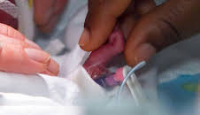 Kleines Leben - große Sorgen: Auf der Frühchenstation