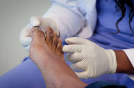 My Feet are Killing Me: Footnotes: Treat My Gorilla Feet!