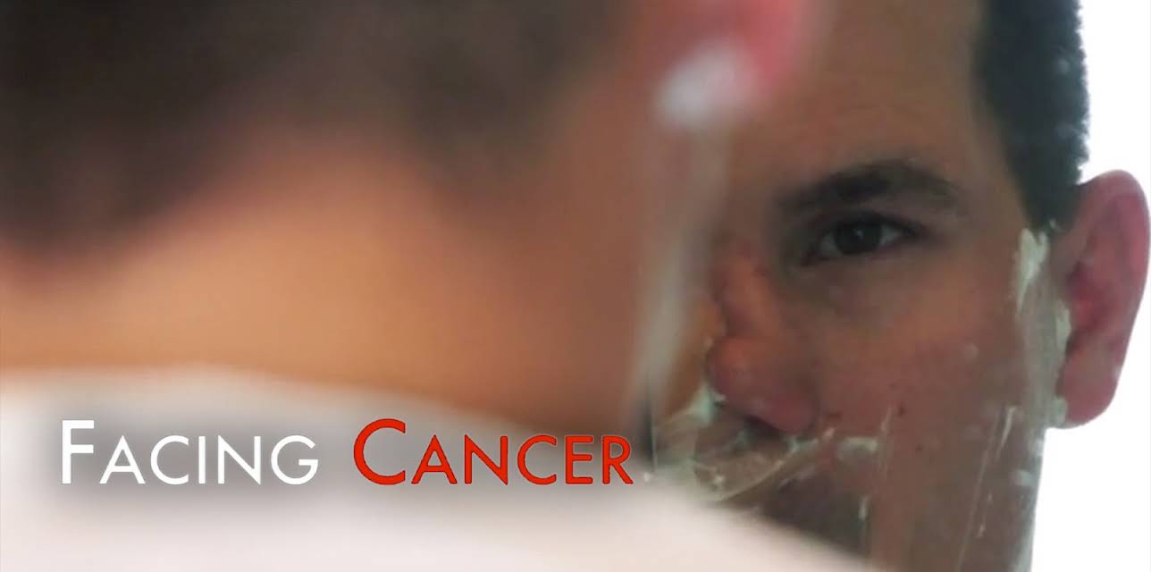 Facing Cancer (2018)