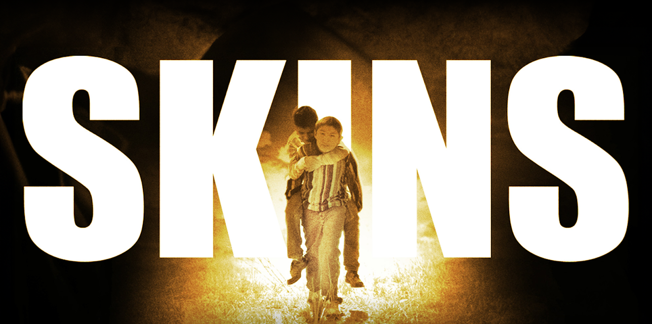 Skins (2002)