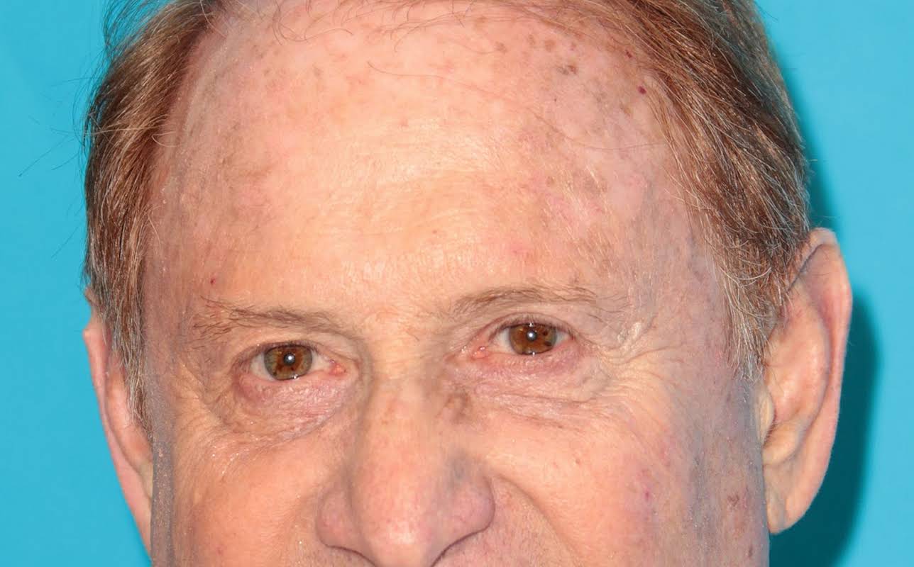 Mike Medavoy