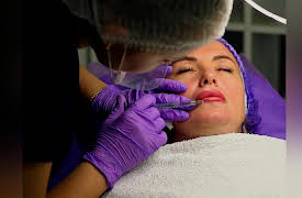 Longevity: E3. Longevity