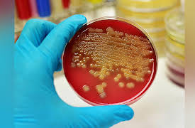 Food, Science, and the Human Body: The Changing Disease-Scape