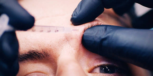 04:25: Body Fixers - Die Beauty Profis | Sixx | 1/24 2026