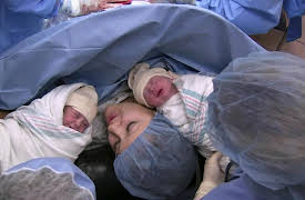 A Baby Story: Baby Arcell