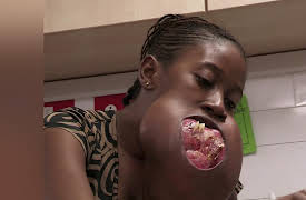 Body Bizarre Season 1: My New Face